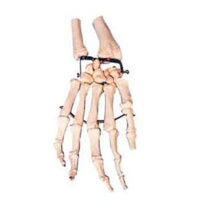 Palm Bone with Elbow-bone and Radial Bone Model AM-11125