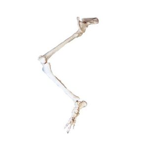 Lower Limb with Hip Bone Model AM-11130
