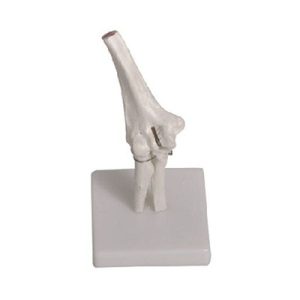 Elbow Joint Model AM-11201-2