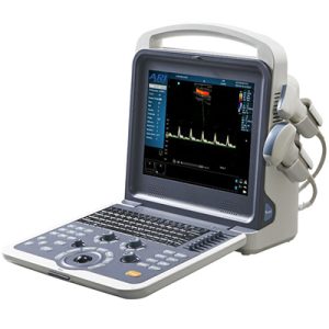 Portable Color Doppler Ultrasound Scanner AM-480B