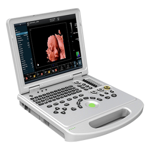Ultrasound Scanner 5D Color Doppler AM-K5