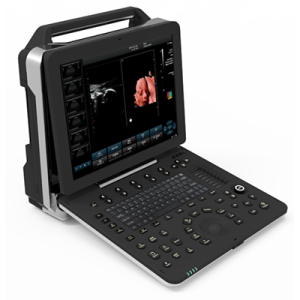 Ultrasound Scanner 5D Color Doppler AM-K6
